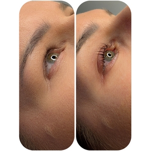 Koreański lifting rzęs – odżywia, unosi i wzmacnia